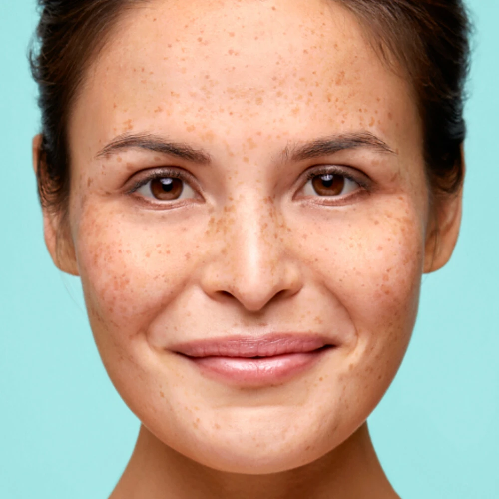 Biodermal Gelcreme Vette & Gemengde Huid - Afbeelding 2